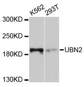 UBN2 Antibody - Western blot analysis of extracts of various cell lines, using UBN2 antibody at 1:1000 dilution. The secondary antibody used was an HRP Goat Anti-Rabbit IgG (H+L) at 1:10000 dilution. Lysates were loaded 25ug per lane and 3% nonfat dry milk in TBST was used for blocking. An ECL Kit was used for detection and the exposure time was 90s.
