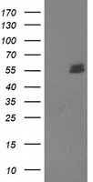 UBOX5 Antibody - HEK293T cells were transfected with the pCMV6-ENTRY control (Left lane) or pCMV6-ENTRY UBOX5 (Right lane) cDNA for 48 hrs and lysed. Equivalent amounts of cell lysates (5 ug per lane) were separated by SDS-PAGE and immunoblotted with anti-UBOX5.