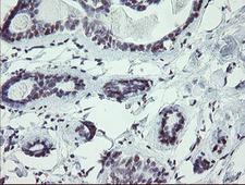 UBOX5 Antibody - IHC of paraffin-embedded Human breast tissue using anti-UBOX5 mouse monoclonal antibody.