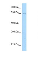 UBOX5 Antibody - UBOX5 antibody Western blot of Mouse Heart lysate. Antibody concentration 1 ug/ml.  This image was taken for the unconjugated form of this product. Other forms have not been tested.