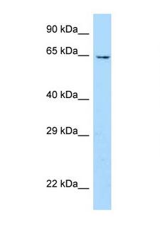 UBOX5 Antibody - UBOX5 antibody Western blot of Mouse Heart lysate. Antibody concentration 1 ug/ml.  This image was taken for the unconjugated form of this product. Other forms have not been tested.