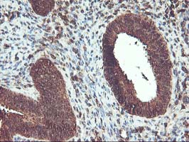 UBOX5 Antibody - IHC of paraffin-embedded Human endometrium tissue using anti-UBOX5 mouse monoclonal antibody. (Heat-induced epitope retrieval by 10mM citric buffer, pH6.0, 100C for 10min).
