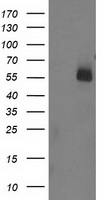 UBOX5 Antibody - HEK293T cells were transfected with the pCMV6-ENTRY control (Left lane) or pCMV6-ENTRY UBOX5 (Right lane) cDNA for 48 hrs and lysed. Equivalent amounts of cell lysates (5 ug per lane) were separated by SDS-PAGE and immunoblotted with anti-UBOX5.