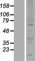UBOX5 Protein - Western validation with an anti-DDK antibody * L: Control HEK293 lysate R: Over-expression lysate