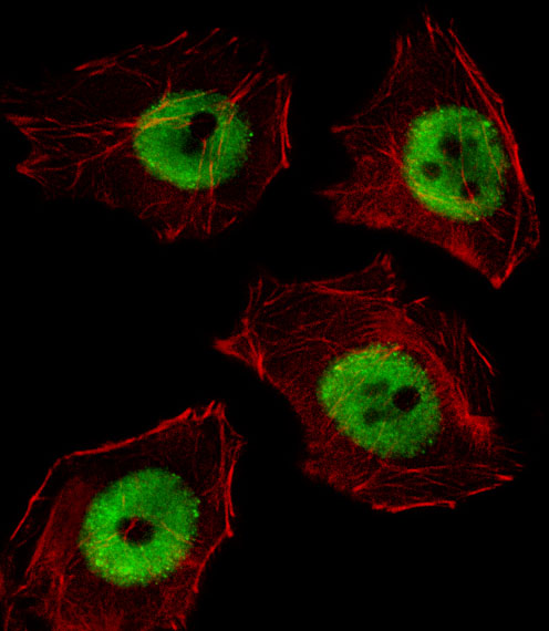 UBP1 Antibody - Fluorescent image of A549 cell stained with UBP1 Antibody. A549 cells were fixed with 4% PFA (20 min), permeabilized with Triton X-100 (0.1%, 10 min), then incubated with UBP1 primary antibody (1:25, 1 h at 37°C). For secondary antibody, Alexa Fluor 488 conjugated donkey anti-rabbit antibody (green) was used (1:400, 50 min at 37°C). Cytoplasmic actin was counterstained with Alexa Fluor 555 (red) conjugated Phalloidin (7units/ml, 1 h at 37°C). UBP1 immunoreactivity is localized to Nucleus significantly.