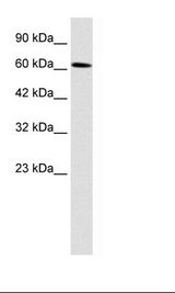 UBP1 Antibody - Daudi Cell Lysate.  This image was taken for the unconjugated form of this product. Other forms have not been tested.