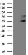 UBP1 Antibody - HEK293T cells were transfected with the pCMV6-ENTRY control. (Left lane) or pCMV6-ENTRY UBP1. (Right lane) cDNA for 48 hrs and lysed
