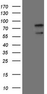 UBP1 Antibody - HEK293T cells were transfected with the pCMV6-ENTRY control. (Left lane) or pCMV6-ENTRY UBP1. (Right lane) cDNA for 48 hrs and lysed. Equivalent amounts of cell lysates. (5 ug per lane) were separated by SDS-PAGE and immunoblotted with anti-UBP1. (1:2000)