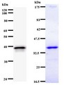 UBP1 Antibody - Western blot of immunized recombinant protein using UBP1 antibody. Left: UBP1 staining. Right: Coomassie Blue staining of immunized recombinant protein.