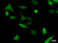 UBP1 Antibody - Immunostaining analysis in HeLa cells. HeLa cells were fixed with 4% paraformaldehyde and permeabilized with 0.1% Triton X-100 in PBS. The cells were immunostained with anti-UBP1 mAb.
