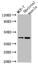 UBP43 / USP18 Antibody - Western Blot Positive WB detected in:MCF-7 whole cell lysate,Mouse skeletal muscle tissue All Lanes:USP18 antibody at 2µg/ml Secondary Goat polyclonal to rabbit IgG at 1/50000 dilution Predicted band size: 44,42 KDa Observed band size: 44 KDa
