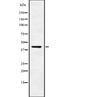 UBP43 / USP18 Antibody - Western blot analysis of USP18 using Jurkat whole lysates.