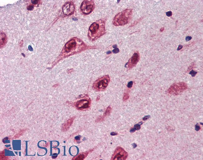 UBQLN1 / Ubiquilin Antibody - Anti-UBQLN1 antibody IHC of human brain, cortex. Immunohistochemistry of formalin-fixed, paraffin-embedded tissue after heat-induced antigen retrieval. Antibody concentration 5 ug/ml.  This image was taken for the unconjugated form of this product. Other forms have not been tested.