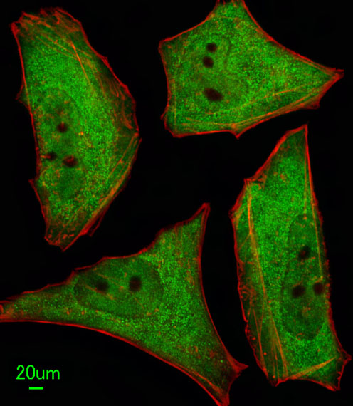 UBQLN1 / Ubiquilin Antibody - Immunofluorescence of HeLa cells, using Ubiquilin1 Antibody. Antibody was diluted at 1:100 dilution. Alexa Fluor 488-conjugated goat anti-rabbit lgG at 1:400 dilution was used as the secondary antibody (green). Cytoplasmic actin was counterstained with Dylight Fluor 554 (red) conjugated Phalloidin (red).