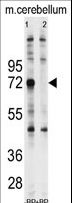 UBQLN1 / Ubiquilin Antibody - Western blot of anti-Ubiquilin1 Antibody pre-incubated with and without blocking peptide (BP2176a) in Jurkat cell line lysate. Ubiquilin1 (arrow) was detected using the purified antibody.