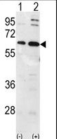 UBQLN1 / Ubiquilin Antibody - Western blot of Ubiquilin1 (arrow) using Ubiquilin1 Antibody. 293 cell lysates (2 ug/lane) either nontransfected (Lane 1) or transiently transfected with the Ubiquilin1 gene (Lane 2) (Origene Technologies).