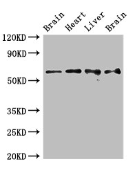 UBQLN1 / Ubiquilin Antibody - Positive WB detected in:Rat brain tissue,Rat heart tissue,Mouse liver tissue,Mouse brain tissue;All lanes:UBQLN1 antibody at 2.4?g/ml;Secondary;Goat polyclonal to rabbit IgG at 1/50000 dilution;Predicted band size: 63,60,44,19 KDa;Observed band size: 63 KDa;