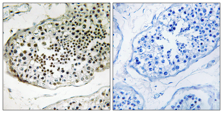 UBQLN3 Antibody - Immunohistochemistry analysis of paraffin-embedded human testis tissue, using UBQLN3 Antibody. The picture on the right is blocked with the synthesized peptide.
