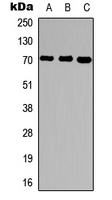 UBQLN3 Antibody - Western blot analysis of Ubiquilin 3 expression in HepG2 (A); rat brain (B); rat liver (C) whole cell lysates.