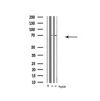 UBQLN3 Antibody - Western blot analysis of UBQLN3 expression in various lysates