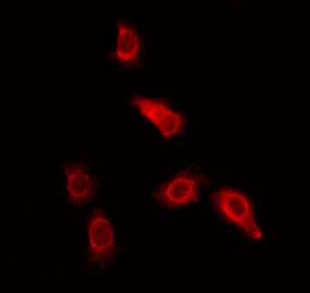 UBQLN3 Antibody - Staining HeLa cells by IF/ICC. The samples were fixed with PFA and permeabilized in 0.1% Triton X-100, then blocked in 10% serum for 45 min at 25°C. The primary antibody was diluted at 1:200 and incubated with the sample for 1 hour at 37°C. An Alexa Fluor 594 conjugated goat anti-rabbit IgG (H+L) Ab, diluted at 1/600, was used as the secondary antibody.