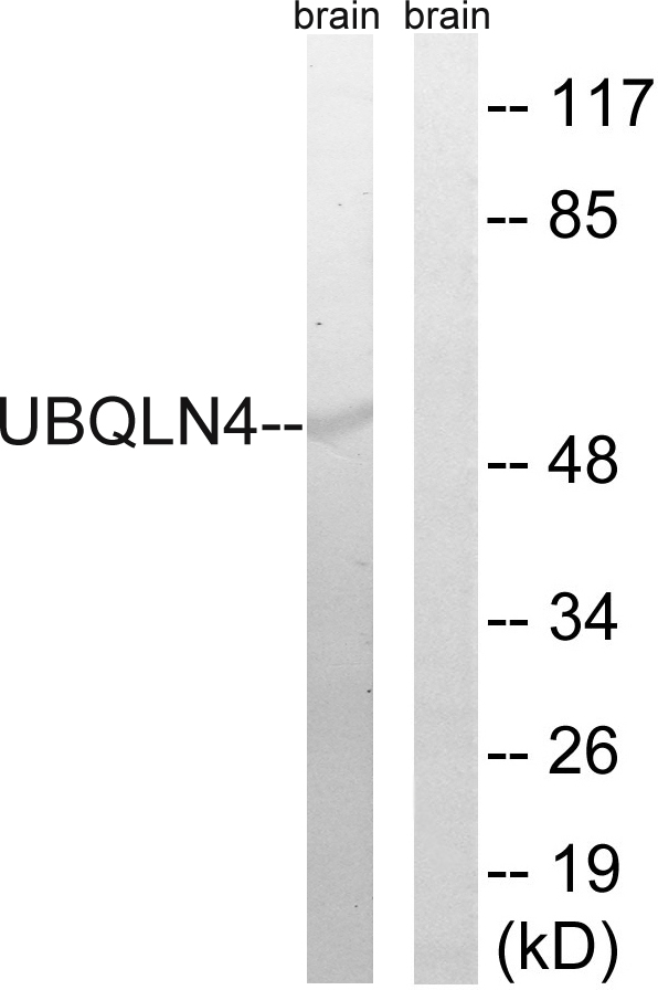 UBQLN4 Antibody - Western blot analysis of lysates from mouse brain, using UBQLN4 Antibody. The lane on the right is blocked with the synthesized peptide.