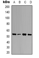 UBQLN4 Antibody - Western blot analysis of Ubiquilin 4 expression in HEK293T (A); K562 (B); NIH3T3 (C); mouse brain (D) whole cell lysates.