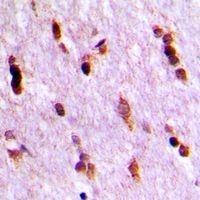 UBQLN4 Antibody - Immunohistochemical analysis of Ubiquilin 4 staining in human brain formalin fixed paraffin embedded tissue section. The section was pre-treated using heat mediated antigen retrieval with sodium citrate buffer (pH 6.0). The section was then incubated with the antibody at room temperature and detected with HRP and DAB as chromogen. The section was then counterstained with hematoxylin and mounted with DPX.