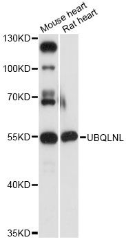 UBQLNL Antibody - Western blot analysis of extracts of various cell lines, using UBQLNL antibody at 1:3000 dilution. The secondary antibody used was an HRP Goat Anti-Rabbit IgG (H+L) at 1:10000 dilution. Lysates were loaded 25ug per lane and 3% nonfat dry milk in TBST was used for blocking. An ECL Kit was used for detection and the exposure time was 30s.
