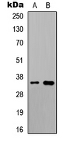 UBR1 Antibody - Western blot analysis of UBR1 expression in HeLa (A); rat muscle (B) whole cell lysates.