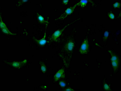 UBR1 Antibody - Immunofluorescence staining of U251 cells at a dilution of 1:166, counter-stained with DAPI. The cells were fixed in 4% formaldehyde, permeabilized using 0.2% Triton X-100 and blocked in 10% normal Goat Serum. The cells were then incubated with the antibody overnight at 4 °C.The secondary antibody was Alexa Fluor 488-congugated AffiniPure Goat Anti-Rabbit IgG (H+L) .