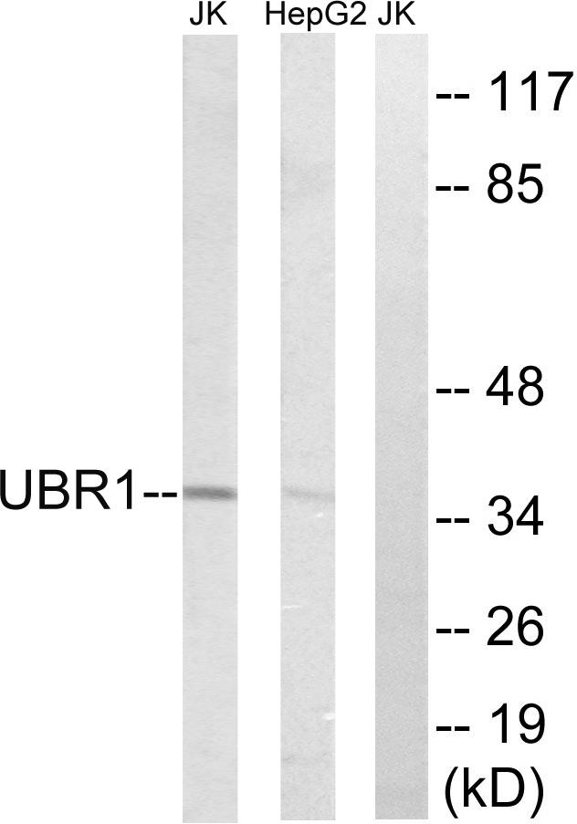 UBR1 Antibody - Western blot analysis of extracts from Jurkat cells and HepG2 cells, using UBR1 antibody.