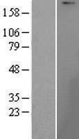 UBR1 Protein - Western validation with an anti-DDK antibody * L: Control HEK293 lysate R: Over-expression lysate