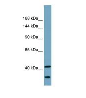 UBR2 Antibody - Western blot of Human Fetal Small Intestine. UBR2 antibody dilution 1.0 ug/ml.  This image was taken for the unconjugated form of this product. Other forms have not been tested.