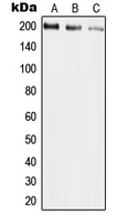 UBR2 Antibody - Western blot analysis of UBR2 expression in HepG2 (A); mouse liver (B); rat liver (C) whole cell lysates.