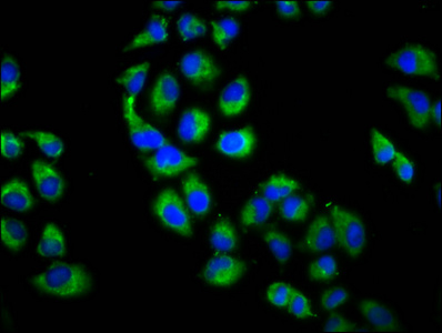 UBR3 Antibody - Immunofluorescence staining of Hela cells diluted at 1:200, counter-stained with DAPI. The cells were fixed in 4% formaldehyde, permeabilized using 0.2% Triton X-100 and blocked in 10% normal Goat Serum. The cells were then incubated with the antibody overnight at 4°C.The Secondary antibody was Alexa Fluor 488-congugated AffiniPure Goat Anti-Rabbit IgG (H+L).