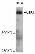 UBR4 Antibody - Western blot analysis of extracts of HeLa cells, using UBR4 antibody at 1:3000 dilution. The secondary antibody used was an HRP Goat Anti-Rabbit IgG (H+L) at 1:10000 dilution. Lysates were loaded 25ug per lane and 3% nonfat dry milk in TBST was used for blocking. An ECL Kit was used for detection and the exposure time was 90s.