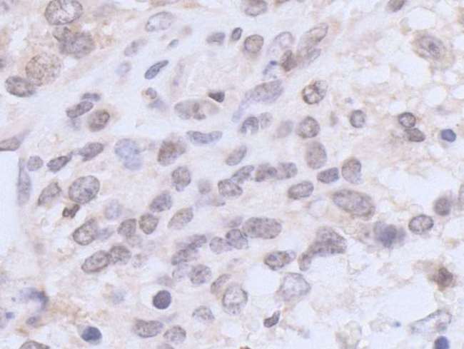 UBR5 Antibody - Detection of mouse EDD1 by immunohistochemistry. Sample: FFPE section of mouse teratoma. Antibody: Affinity purified rabbit anti-EDD1 used at a dilution of 1:1,000 (1µg/ml). Detection: DAB