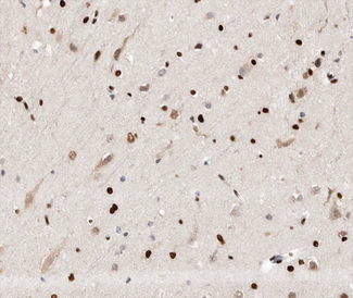 UBR5 Antibody - 1:100 staining human brain tissue by IHC-P. The tissue was formaldehyde fixed and a heat mediated antigen retrieval step in citrate buffer was performed. The tissue was then blocked and incubated with the antibody for 1.5 hours at 22°C. An HRP conjugated goat anti-rabbit antibody was used as the secondary.