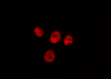UBR5 Antibody - Staining A549 cells by IF/ICC. The samples were fixed with PFA and permeabilized in 0.1% Triton X-100, then blocked in 10% serum for 45 min at 25°C. The primary antibody was diluted at 1:200 and incubated with the sample for 1 hour at 37°C. An Alexa Fluor 594 conjugated goat anti-rabbit IgG (H+L) Ab, diluted at 1/600, was used as the secondary antibody.