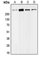 UBR5 Antibody - Western blot analysis of UBR5 expression in Jurkat (A); HeLa (B); MDAMB468 (C); NIH3T3 (D) whole cell lysates.