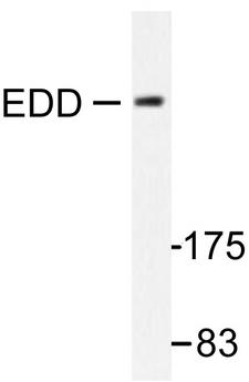 UBR5 Antibody - Western blot of EDD (T14) pAb in extracts from A549 cells.
