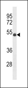 UBR7 / C14orf130 Antibody - UBR7 Antibody western blot of MDA-MB231 cell line lysates (35 ug/lane). The UBR7 antibody detected the UBR7 protein (arrow).