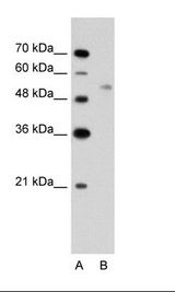 UBR7 / C14orf130 Antibody - A: Marker, B: Jurkat Cell Lysate.  This image was taken for the unconjugated form of this product. Other forms have not been tested.