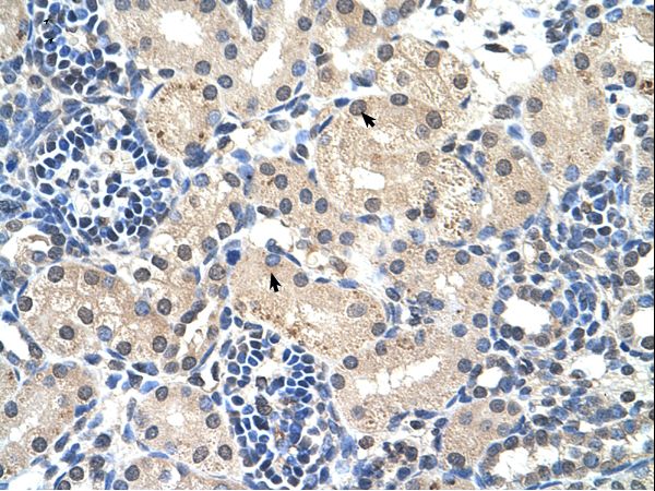 UBR7 / C14orf130 Antibody - UBR7 / C14orf130 antibody ARP43242_T100-NP_786924-C14ORF130 Antibody was used in IHC to stain formalin-fixed, paraffin-embedded human kidney.  This image was taken for the unconjugated form of this product. Other forms have not been tested.