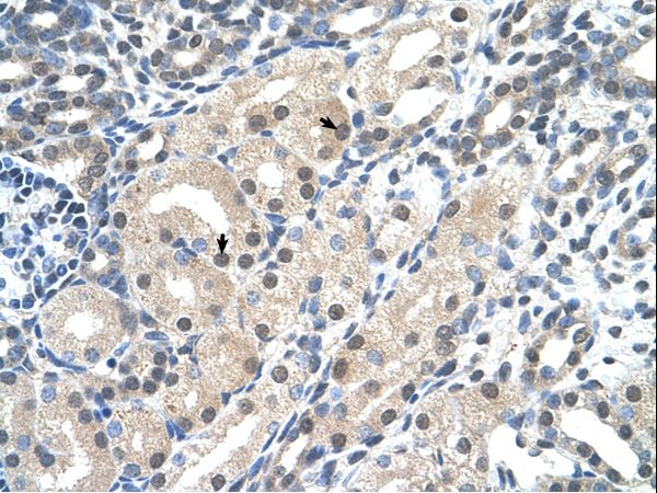 UBR7 / C14orf130 Antibody - UBR7 / C14orf130 antibody ARP43243_T100-AAH15046-C14ORF130 Antibody was used in IHC to stain formalin-fixed, paraffin-embedded human kidney.  This image was taken for the unconjugated form of this product. Other forms have not been tested.