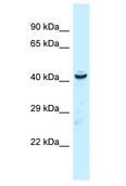 UBR7 / C14orf130 Antibody - UBR7 / C14orf130 antibody Western Blot of Rat Liver. Antibody dilution: 1 ug/ml.  This image was taken for the unconjugated form of this product. Other forms have not been tested.