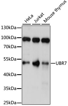 UBR7 / C14orf130 Antibody - Western blot analysis of extracts of various cell lines, using UBR7 antibody at 1:1000 dilution. The secondary antibody used was an HRP Goat Anti-Rabbit IgG (H+L) at 1:10000 dilution. Lysates were loaded 25ug per lane and 3% nonfat dry milk in TBST was used for blocking. An ECL Kit was used for detection and the exposure time was 5s.