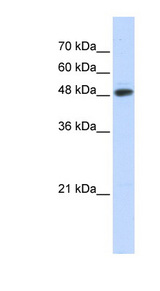 UBR7 / C14orf130 Antibody - UBR7 / C14orf130 antibody Western blot of Transfected 293T cell lysate. This image was taken for the unconjugated form of this product. Other forms have not been tested.