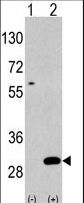 UBTD1 Antibody - Western blot of UBTD1(arrow) using rabbit polyclonal UBTD1 Antibody (C-term G195) polyclonal antibody. 293 cell lysates (2 ug/lane) either nontransfected (Lane 1) or transiently transfected with the UBTD1 gene (Lane 2) (Origene Technologies).